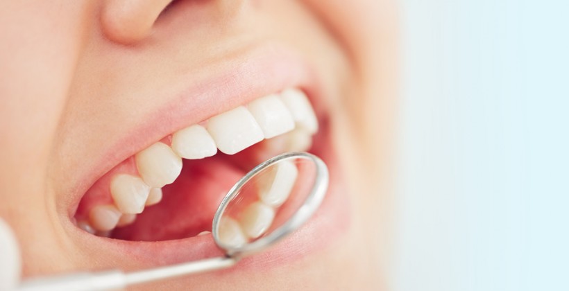 Cum sa Prevenim Cariile